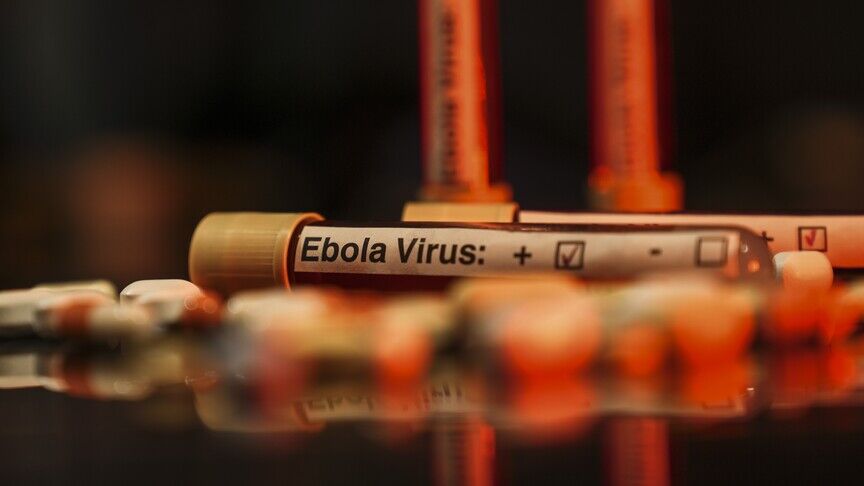 ABD'de bazı havalimanlarında Ebola tarama merkezleri kuracak