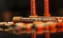 ABD'de bazı havalimanlarında Ebola tarama merkezleri kuracak