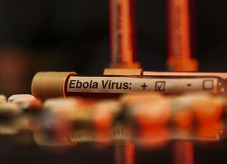 ABD'de bazı havalimanlarında Ebola tarama merkezleri kuracak