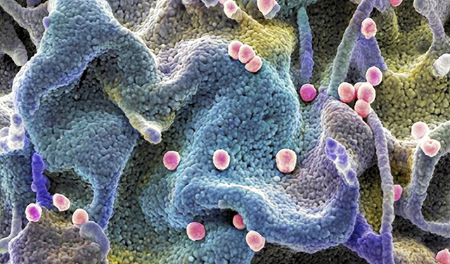 HIV Tedavisinde Yeni Ufuk: Virüsün Gizlendiği Hücreleri "İntihara Zorlayan" Yöntem Geliştirildi