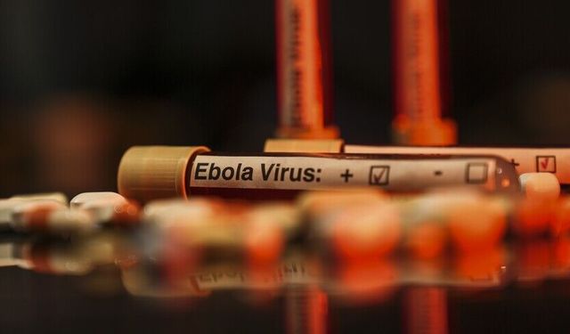 ABD'de bazı havalimanlarında Ebola tarama merkezleri kuracak
