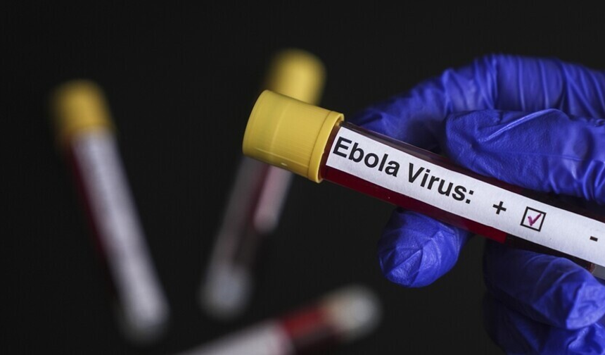 DSÖ, Ebola salgınının görüldüğü KDC ve Uganda'ya seyahat ve ticaret kısıtlaması önermiyor